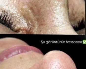 WhatsApp-Image-2026-03-13-at-19.31.32-2