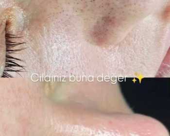 WhatsApp-Image-2026-03-13-at-19.31.32